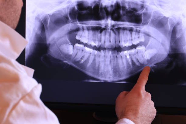 Best Broken or Cracked Tooth Emergency Dentist in Grafton, WV